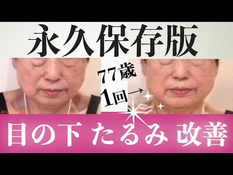 【たるみ改善】目の下のたるみを今すぐ改善する方法